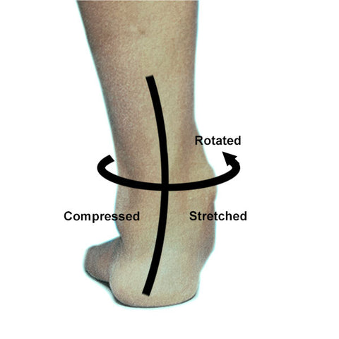 Foot biomechnics and Plantar fasciitis without an insole