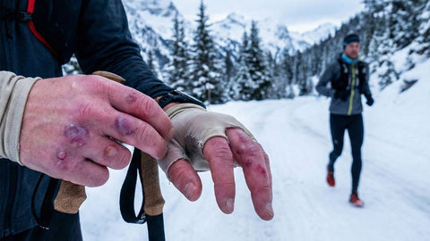 running gloves prevent cold injury