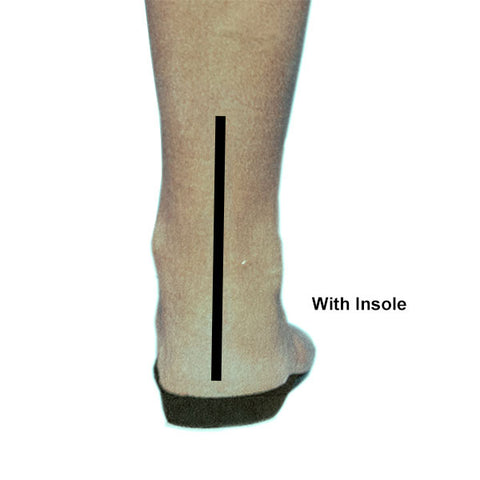 plantar fasciitis insoles